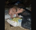 Φθιώτιδα: Έκκληση για τη σωτηρία του άρρωστου σκύλου που περιφέρεται σε σκουπιδότοπο στα Καμένα Βούρλα