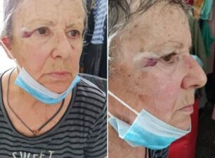 Βαθύ Εύβοιας: Γυναίκα καταγγέλλει ότι παπάς τη χτύπησε με σκούπα επειδή έβαλε νερό στις αδέσποτες γάτες