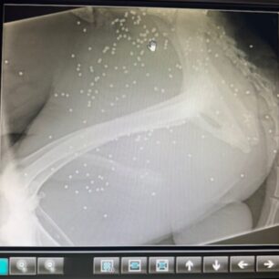 KryoneriAitoloakarnaniasPyrovolimenosSkylosAktinografia3 10 2025 3