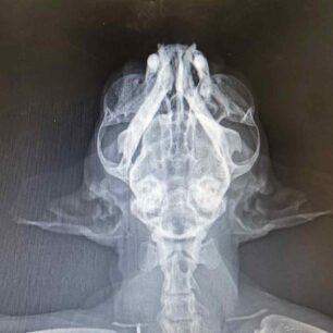 MarousiGataPyrovolimeniAerovoloAktinografia23 10 2025 2