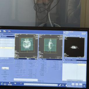 Φροντίζουν το χελωνάκι με τα δύο κεφάλια που βρέθηκε στην Αιτωλοακαρνανία 3 HelonakiSiamaioDyoKefaliaAitoloakarnania6 2 2026 2